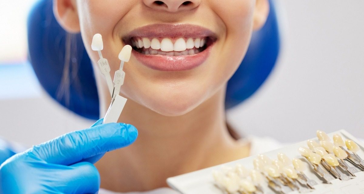 Faccette Dentali in Albania: Qualità e Prezzi Competitivi