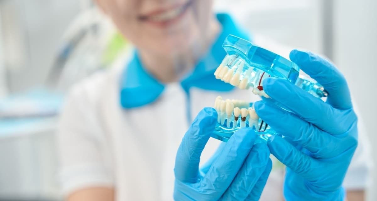 Migliori Materiali per Impianti Dentali: Titanio e Zirconio a Confronto