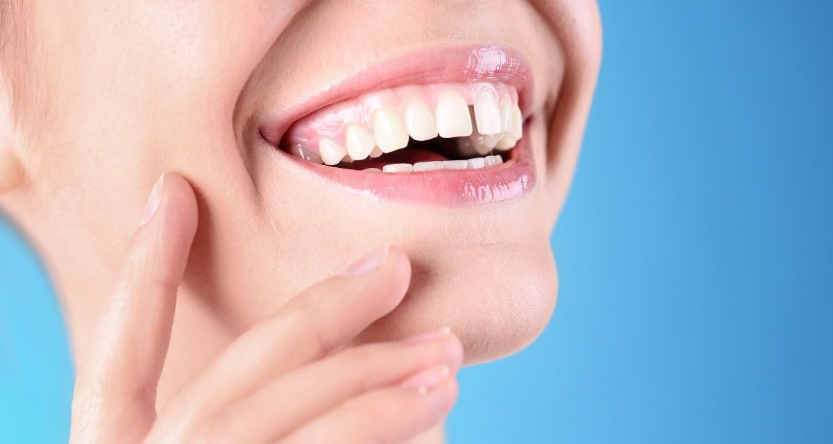 Diastema Dentale: Come Eliminare lo Spazio tra i Denti