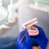 Cos’è l’Agenesia Dentale? Cause, Tipologie e Soluzioni Efficaci